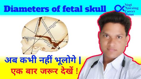 Diameters of fetal skull | Part- 2 - YouTube