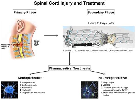 Treatment for spinal cord injury – Atlas of Science