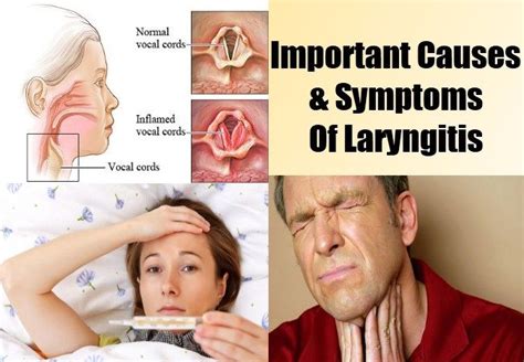 Important Causes And Symptoms Of Laryngitis | Symptoms, Laryngitis symptoms, Chronic