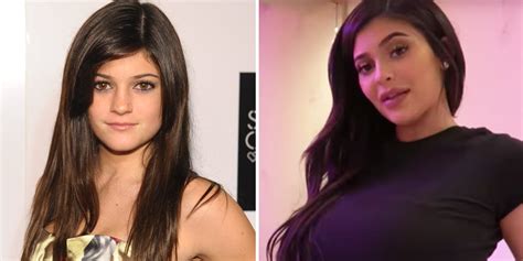 Kylie Jenner Beauty Transformation Timeline - Kylie Jenner Makeup ...