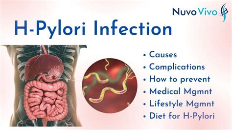 Don't Let H-Pylori Ruin Your Digestive Health: Here's What You Need to Know! - NuvoVivo