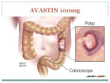 PPT – Avastin 100mg - Anticancer drugs | view uses, side effects and ...