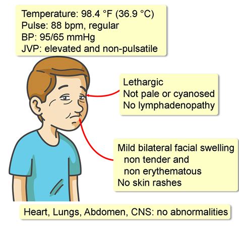 Vena Cava Syndrome