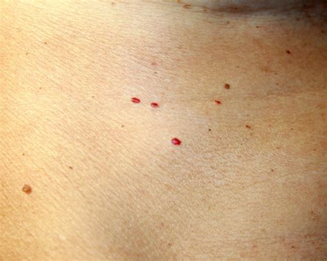 7 Causes of Red Spots and Bumps on Skin, With Pictures | Allure