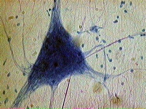 Spinal Motor Neuron/ Anaxonic Neuron Histology Diagram | Quizlet