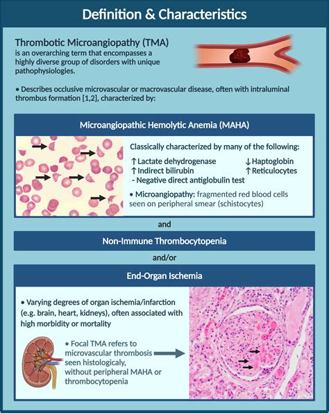 Thrombotic microangiopathies: An illustrated review - Research and Practice in Thrombosis and ...