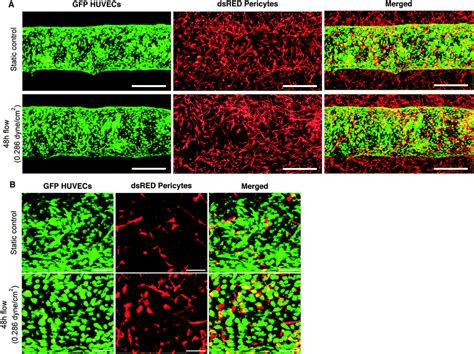 A new microfluidic model that allows monitoring of complex vascular structures and cell ...