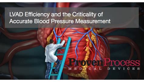 LVAD Efficiency and the Criticality of Accurate Blood Pressure Measurement - MassDevice