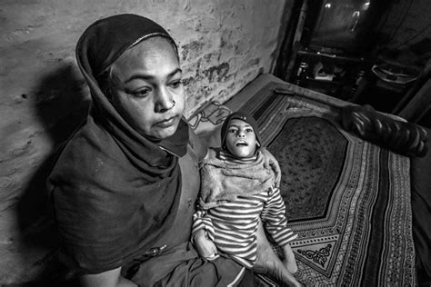 Bhopal disaster 31st anniversary: Photos show children still born with deformities