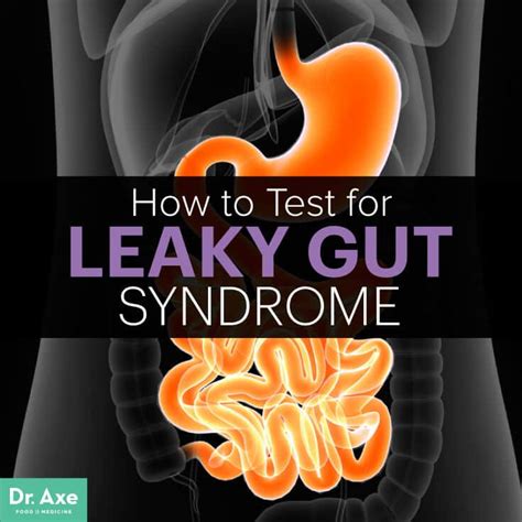 Weight Loss News and Tips: Is Your Gut Leaky Making You Fat And Sick