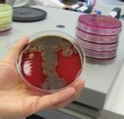 Bacterial Identification