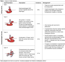 [PDF] Bowel in Chest: Type IV Hiatal Hernia | Semantic Scholar