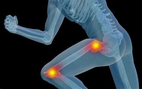 Hip And Knee Pain: Are They Related? - Space Coast OrthopedicMerritt ...