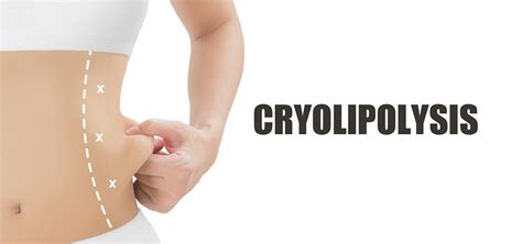 Cryolipolysis – Skin City India