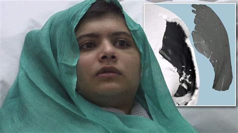 Malala: Shot Teen's Surgery 'Successful'