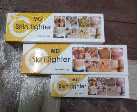 MD skin fighter cream for skin allergies 8g,15g, 35g available in 1 pc ...