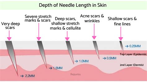 Pin on Microneedling