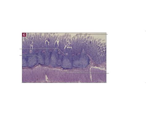 Peyer's Patches in the Ileum Quiz