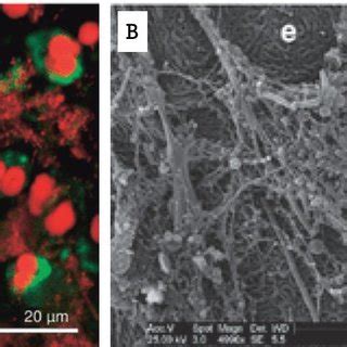 Extracellular neutrophil traps in periodontitis. (a) Confocal... | Download Scientific Diagram