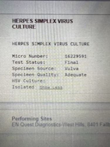 Culture results | Genital Herpes Simplex | Forums