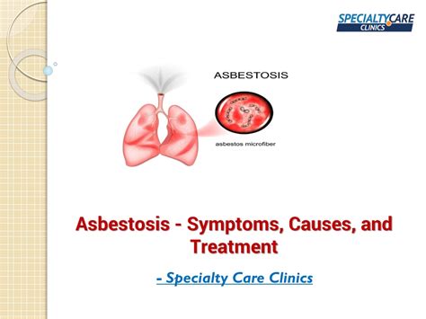 PPT - Asbestosis - Symptoms, Causes, and Treatment PowerPoint ...