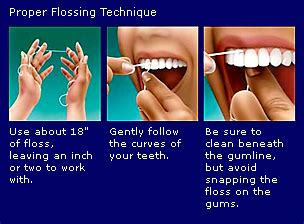 Basic Practices for Excellent Dental Health