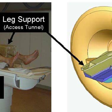 Proposed patient positioning in the semi-lithotomy position on the leg ...