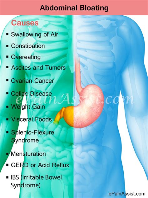 What To Take For Bloated Stomach - Aaron Easton's Blog