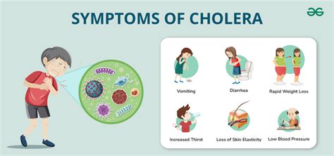 Cholera Disease: Causes, Symptoms, Treatment and Prevention of Cholera ...