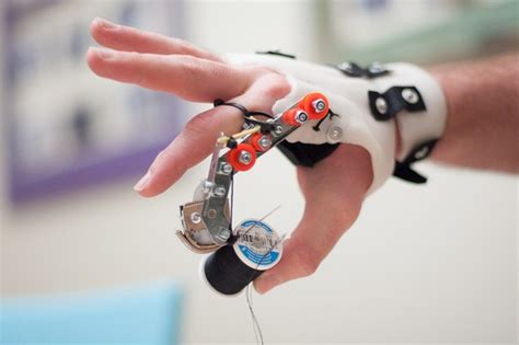 Bloke who lost his finger creates in-expensive prosthetic fingers for the amputees - Atcrux