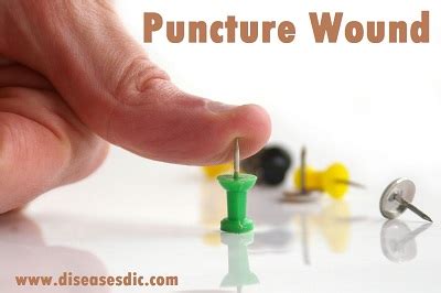 Puncture Wound – Types, First aid and Treatment