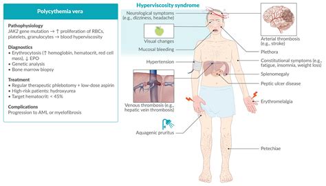 Plethora In Polycythemia Vera