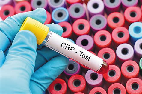 Should you monitor this chronic inflammation marker? - Harvard Health