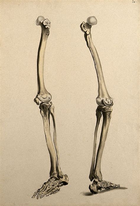 File:Bones of the leg and foot. Ink and watercolour, 1830-1835?, Wellcome V0008214ER.jpg ...