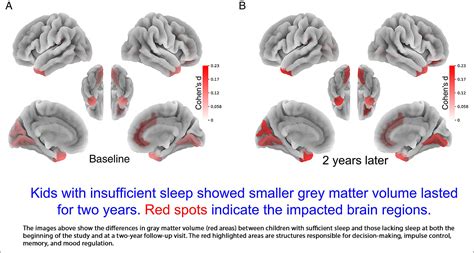 Too Little Sleep Harms Kids' Brain Development - UMB News