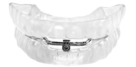 Mandibular Advancement Device | Download Scientific Diagram