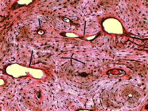 Compact Bone 10x | Histology