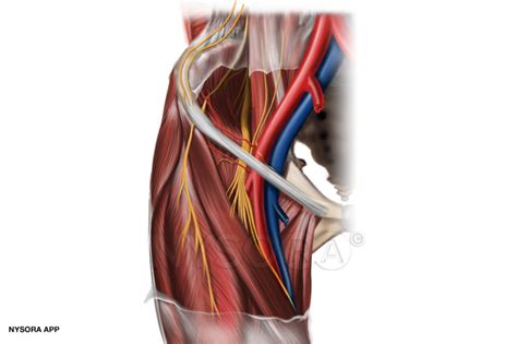 Femoral Nerve Block Anatomy