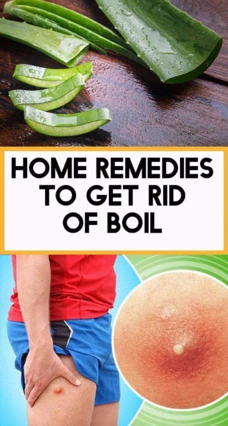 HOME REMEDIES TO GET RID OF BOIL!.. in 2020 | Remedies, Home remedies, Natural remedies