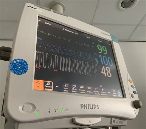 Optical vs chest strap heart rate monitors - Measuring beats per minute ...