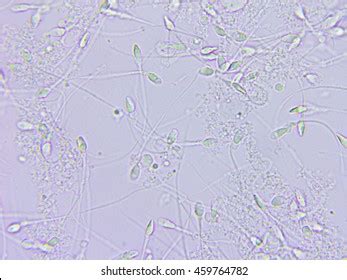 5,326 Sperm Microscope Images, Stock Photos, 3D objects, & Vectors | Shutterstock