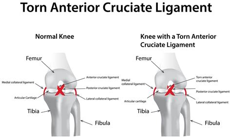 Cruciate Ligament Rupture in Cats - Cat-World