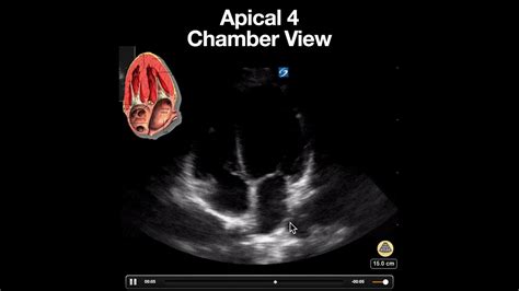 Normal Apical 4 Chamber View - YouTube