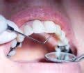 El engaño del empaste y las desventajas de la amalgama dental | Un Misántropo