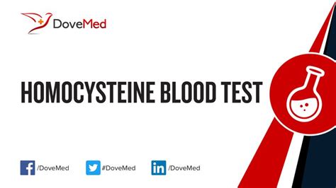 Homocysteine Blood Test