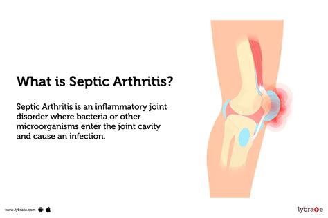 Septic Arthritis: Causes, Symptoms, Treatment and Cost