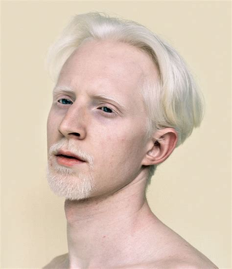 58 Albino People Who’ll Mesmerize You With Their Otherworldly Beauty | Bored Panda