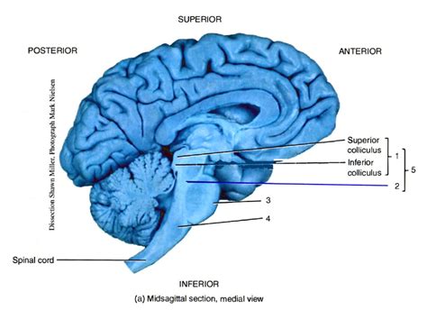 SOLVED: Label the brain stem structures in the figure below Word Bank ...