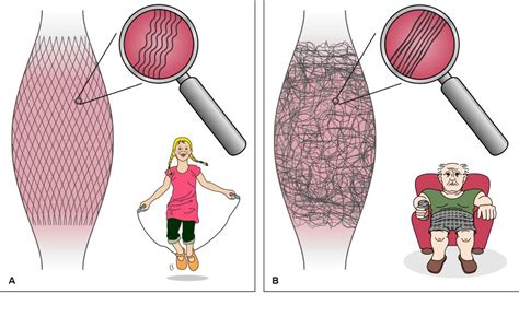 What is Fascia? - Bendable Body