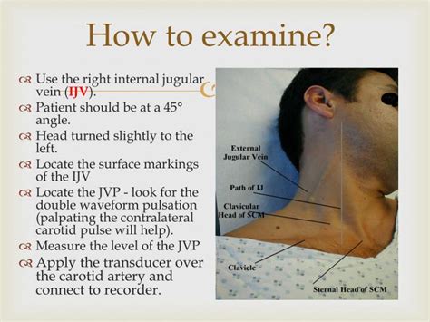 PPT - Jugular Venous Pulse and Carotid Arterial Pulse PowerPoint ...